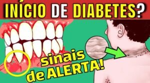 Diabetes: Sintomas Precoces e Prevenção